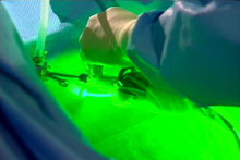 Green Light Laser for treatment of enlarged prostate now available at Mitcham Private Hospital